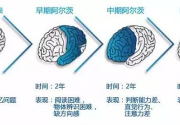 让每位失智老人都活得更有尊严